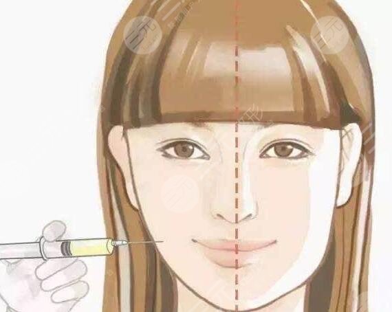 瘦臉針