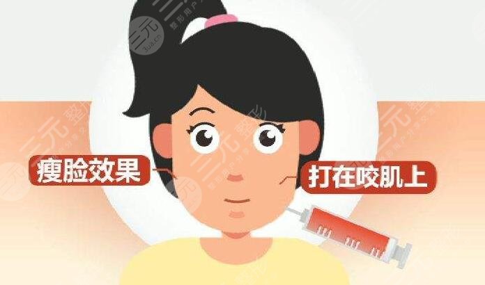 瘦臉針