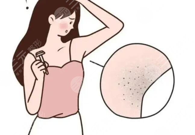 脫腋毛