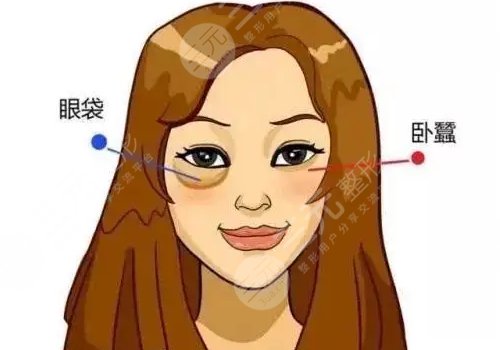 醫(yī)美整形去眼袋多少錢