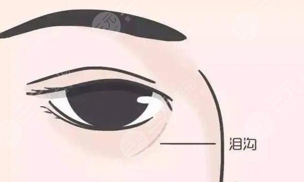 除淚溝