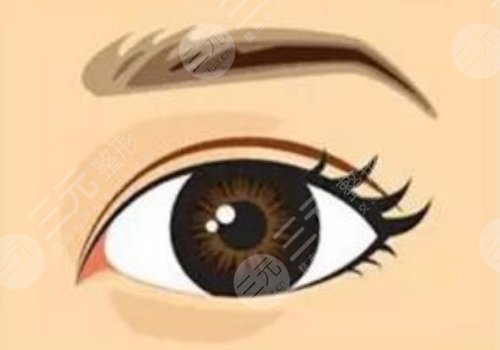 雙眼皮的修復(fù)手術(shù)的價(jià)格是多少