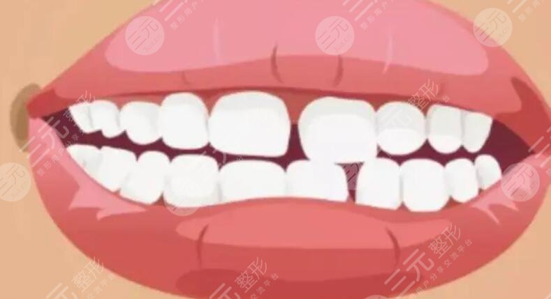 牙縫