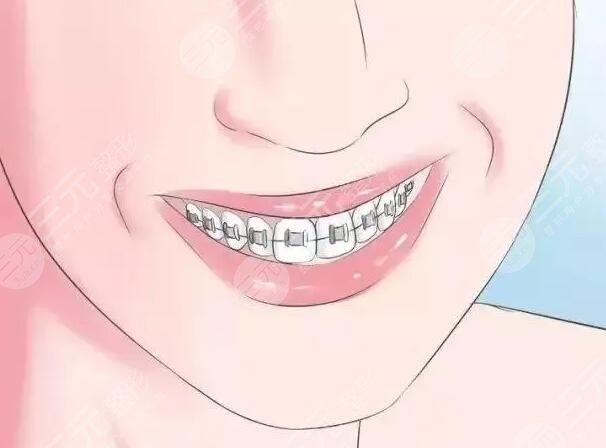 術后小tips
