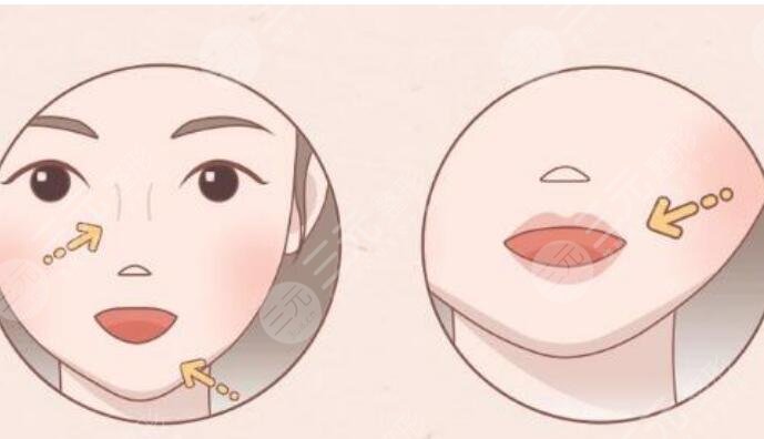 豐唇手術(shù)