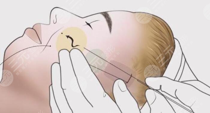 抗衰