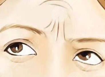 填充川字紋