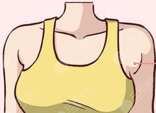 去副乳