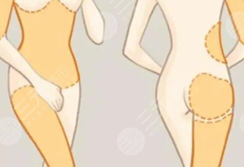 天使光雕