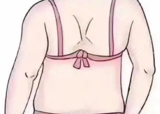 背部吸脂動漫