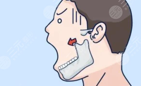 下頜角