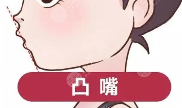 凸嘴