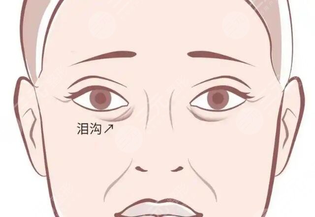 填淚溝