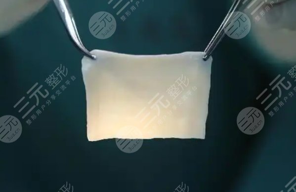 生物補片