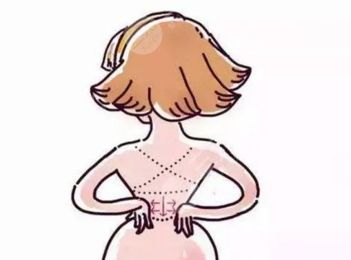 吸脂