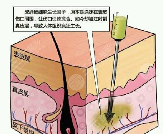 取生長因子