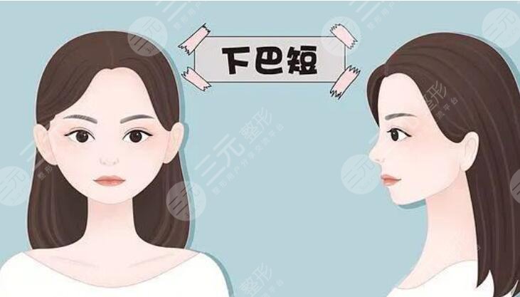 下巴放松針