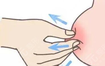 乳暈多熊