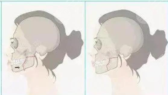 正頜