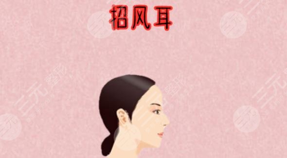 招風耳