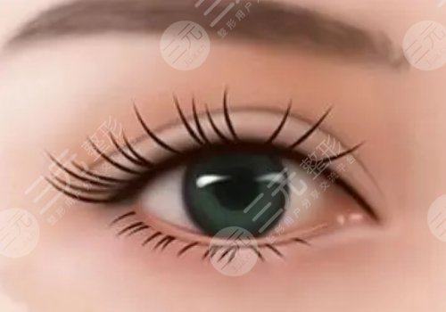北京畫美雙眼皮醫(yī)生排名