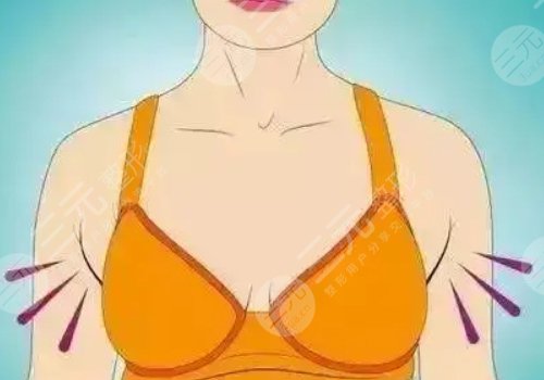 貴陽美貝爾豐胸價(jià)格是多少？大概在2.3w起；性價(jià)比高！