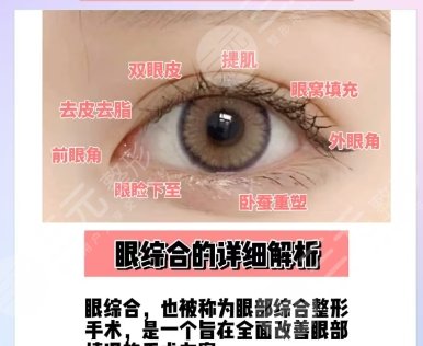雙眼皮