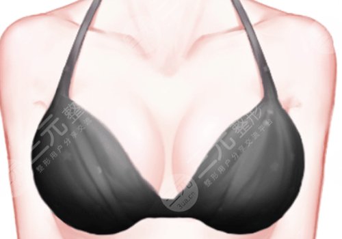 重慶華美曹勇醫(yī)生點(diǎn)名費(fèi)是多少