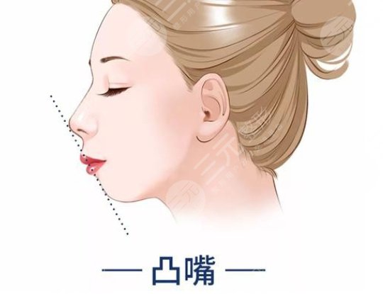 正頜