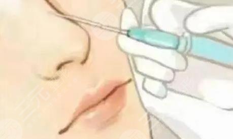隆鼻