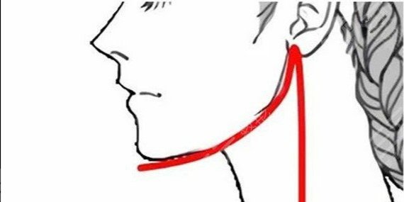 吳國平正頜手術(shù)怎么樣?