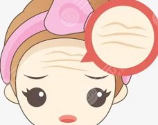 抬頭紋填充的好還是打除皺？還有什么別的方法？科普知識匯總
