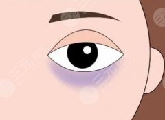 熊貓針去黑眼圈多久見效？好不好？注意事項附上