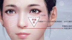 蘋果肌填充的費(fèi)用大概要多少錢呢？填充有哪些方式？