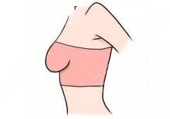 成都軍大梁軍醫(yī)生做乳腺下垂手術怎么樣？經驗豐富、發(fā)揮穩(wěn)定！