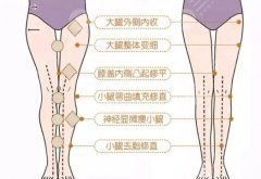 先直腿還是先瘦腿？哪種效果好？術(shù)后指南盤點
