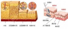 北京面部吸脂多少錢？從7800元到5萬，這樣選不踩坑！