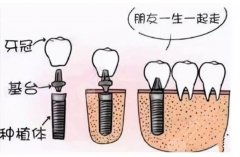 上海種牙避坑圖鑒：10家公立口腔紅榜，從九院到仁濟(jì)全測(cè)評(píng)！