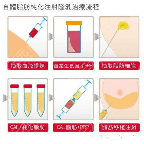 杭州隆胸價(jià)格全景圖