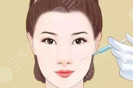 蘋果肌