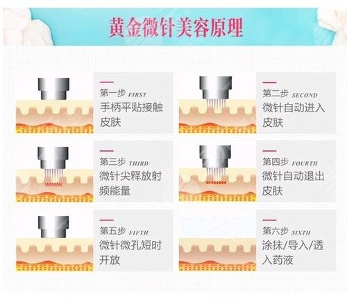 痤瘡疤痕修復、私密年輕化