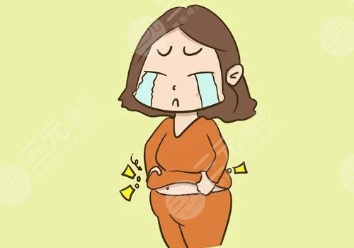 上海曹衛(wèi)剛做腹壁成形術