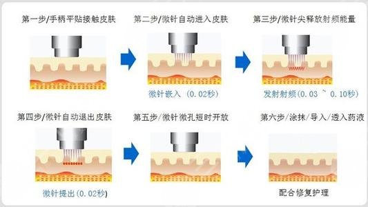 美迪邁vs半島