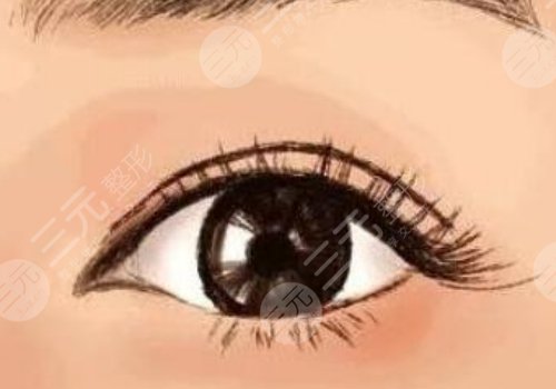 李天石醫(yī)生雙眼皮