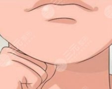 韓式生科和太陽(yáng)的差別墊下巴在哪？3點(diǎn)核心差別講透|新手別選錯(cuò)
